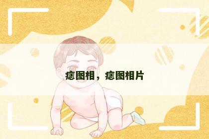 痣图相，痣图相片